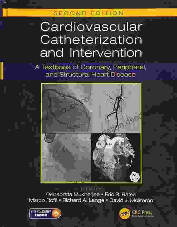 Textbook Of Coronary Peripheral And Structural Heart Disease Second Edition Cardiovascular Catheterization And Intervention: A Textbook Of Coronary Peripheral And Structural Heart Disease Second Edition