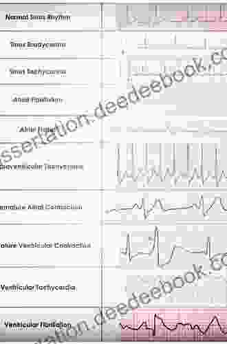 ECG Diagnosis In Clinical Practice