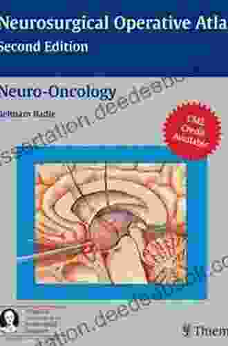 Neuro Oncology (Neurosurgical Operative Atlas) Percy Rossell Perry